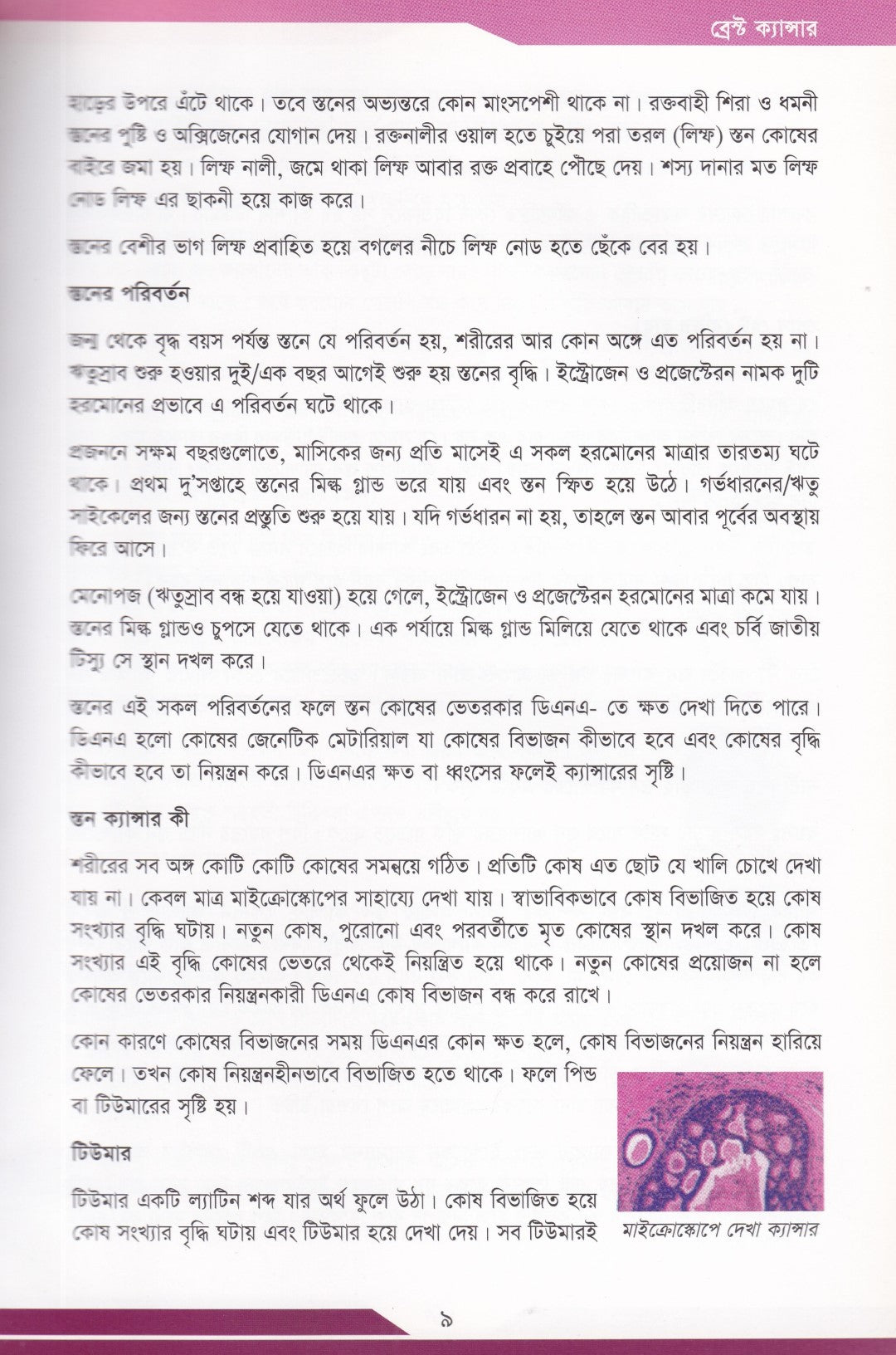 ব্রেস্ট ক্যান্সার