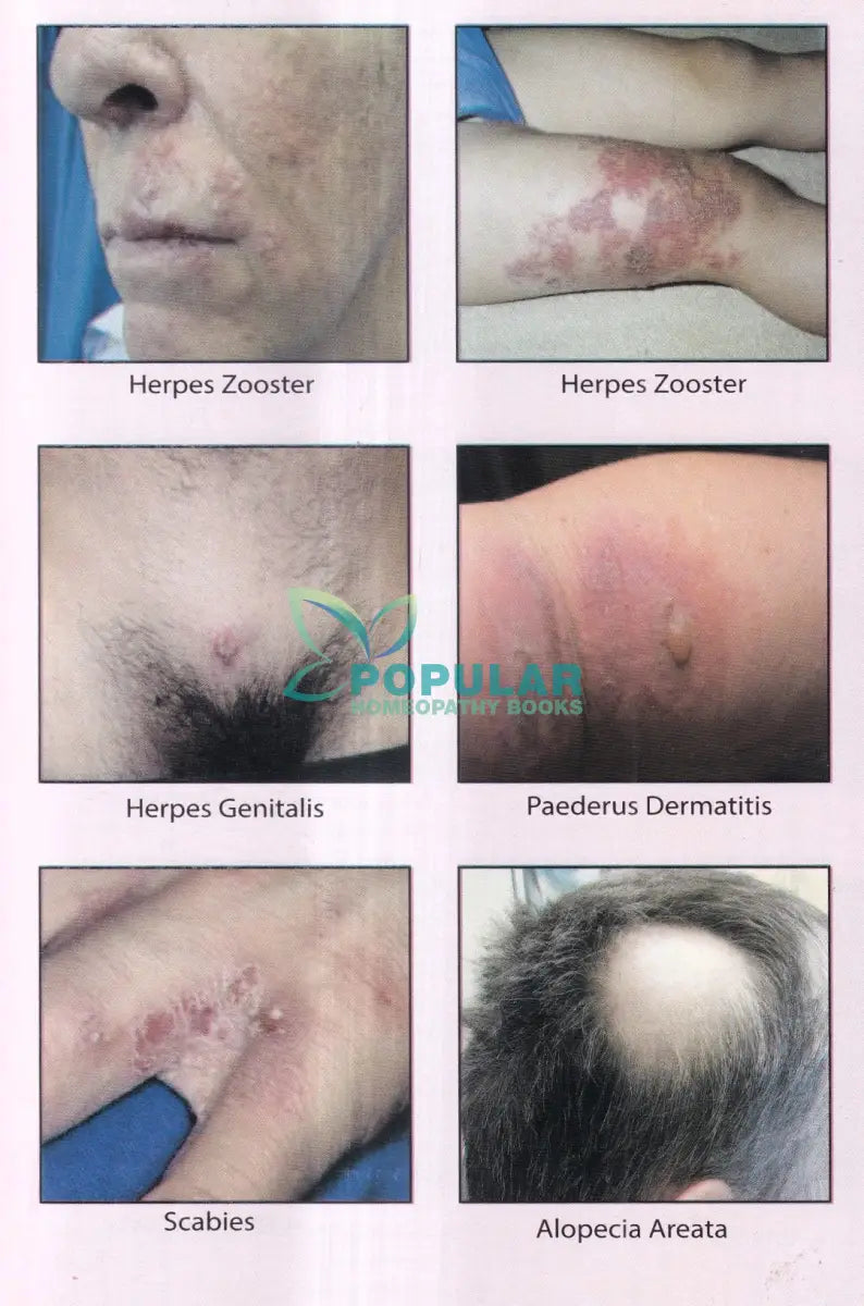 চর্মরোগের হোমিওপ্যাথি চিকিৎসা Homeopathy Books