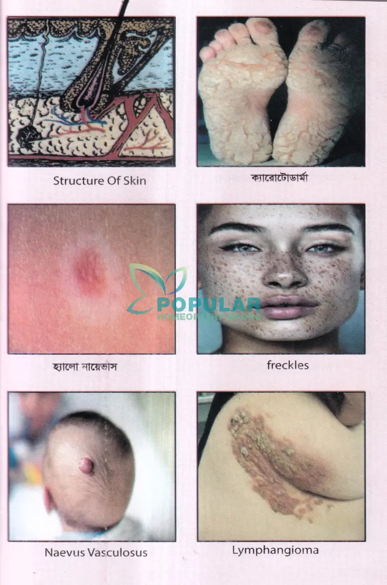 চর্মরোগের হোমিওপ্যাথি চিকিৎসা Homeopathy Books