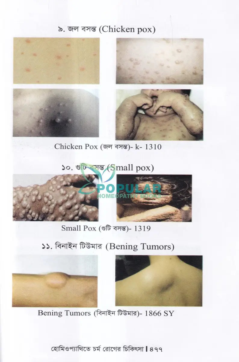 হোমিওপ্যাথিতে চর্ম রোগের চিকিৎসা Homeopathy Books