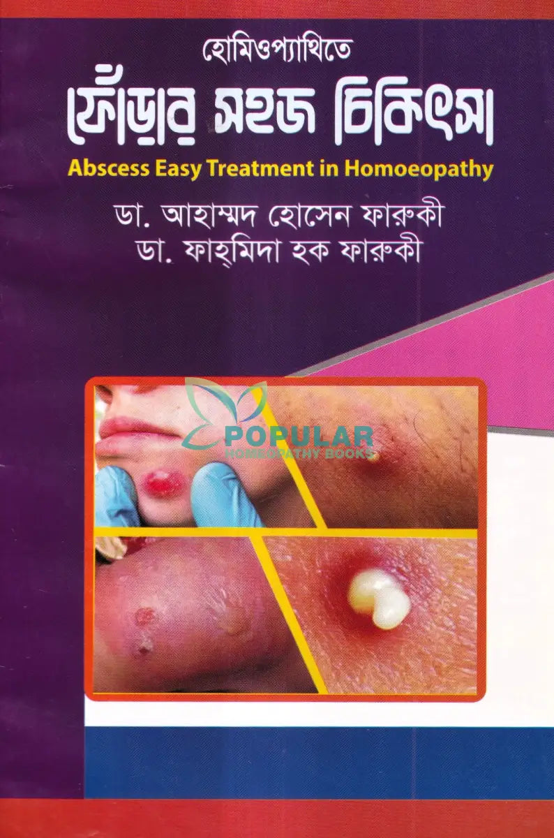 হোমিওপ্যাথিতে ফোঁড়ার সহজ চিকিৎসা Homeopathy Books