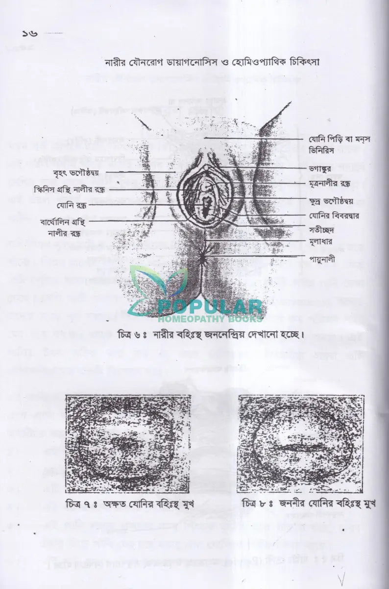 নারীর যৌনরোগ (ডায়াগনোসিস ও হোমিওপ্যাথিক চিকিৎসা) Homeopathy Books